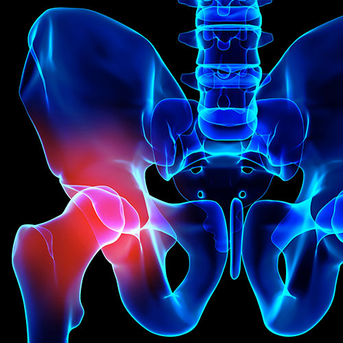 Cheyenne Orthopaedics: Homepage — Orthopedics clinic in Cheyenne, WY — photo 6